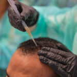 tricologia capelli ricci ed afro